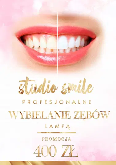  Profesjonalne wybielanie zębów lampą - Studio Smile, promocja 400 zł. 
