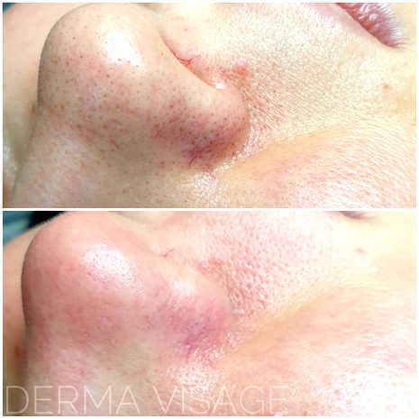 Derma Visage Gabinet Kosmetologii Profesjonalnej - Uroda i zdrowie - photo - 1